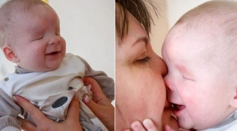 Το μωράκι χωρίς μάτια που συνεχώς χαμογελάει βρήκε σπίτι – Το εγκατέλειψε η μητέρα του μόλις γεννήθηκε